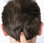Inion on back of head